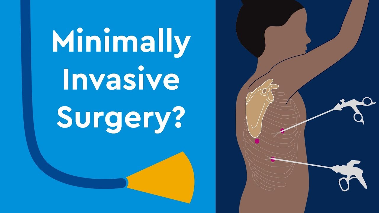 minimally-invasive-surgery